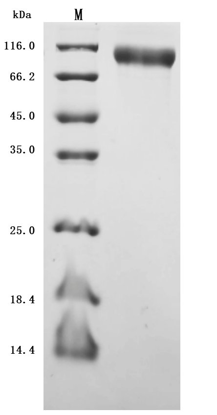 Recombinant Human Microtubule-associated protein tau (MAPT) (Active), Homo sapiens (Human), Mammalian cell, N-terminal 10xHis-tagged, 49.5kDa, purity >95% as determined by SDS-PAGE.