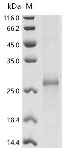 Recombinant Macaca fascicularis Tetraspanin-1 (TSPAN1) Protein, Macaca fascicularis (Crab-eating macaque), in vitro E.coli expression system, N-terminal 10xHis-tagged, 27.8kDa, purity >85% as determined by SDS-PAGE.