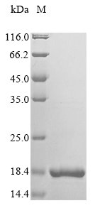 Recombinant Human Microtubule-associated serine/threonine-protein kinase 4 (MAST4), partial
