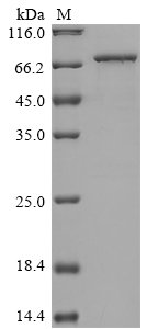 Recombinant Human S-adenosylmethionine synthase isoform type-2 (MAT2A)
