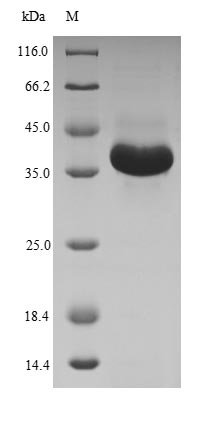 Recombinant Human Membrane-bound transcription factor site-1 protease (MBTPS1), partial
