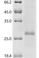 (Tris-Glycine gel) Discontinuous SDS-PAGE (reduced) with 5% enrichment gel and 15% separation gel.