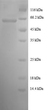 Recombinant Human Malate dehydrogenase, Cytoplasmic (MDH1), partial