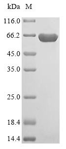Recombinant Human NADP-dependent malic enzyme, mitochondrial (ME3), partial, Homo sapiens (Human), E.coli, N-terminal 6xHis-tagged, 67.2kDa, purity >85% as determined by SDS-PAGE.