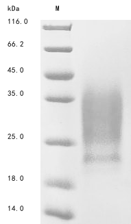 Recombinant Human Homeobox protein Meis1 (MEIS1), partial, Homo sapiens (Human), Yeast, N-terminal 6xHis-tagged, 17.4kDa, purity >90% as determined by SDS-PAGE.