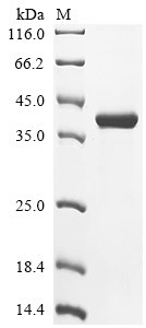 Recombinant Human Melanotransferrin (MELTF), Homo sapiens (Human), E.coli, N-terminal 10xHis-tagged and C-terminal Myc-tagged, 35.7kDa, purity >85% as determined by SDS-PAGE.