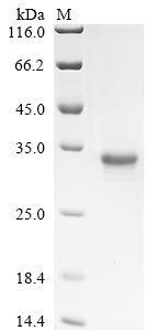 Recombinant Human Melanotransferrin (MFI2), Homo sapiens (Human), Yeast, C-terminal hFc1-tagged, 58.0kDa, purity >90% as determined by SDS-PAGE.