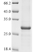 (Tris-Glycine gel) Discontinuous SDS-PAGE (reduced) with 5% enrichment gel and 15% separation gel.