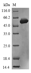 Recombinant Human Meteorin-like protein (METRNL)