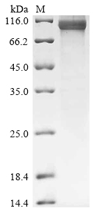 Recombinant Human Maltase-glucoamylase (MGAM), partial