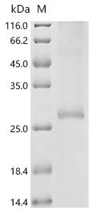 Recombinant Rat Tetraspanin-1 (Tspan1) Protein, Rattus norvegicus (Rat), in vitro E.coli expression system, N-terminal 10xHis-tagged, 28.0kDa, purity >90% as determined by SDS-PAGE.