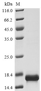 Recombinant Human Macrophage migration inhibitory factor (MIF)
