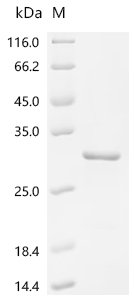 Recombinant Human Allergin-1(MILR1), partial, Homo sapiens (Human), E.coli, N-terminal 6xHis-KSI-tagged, 26.1kDa, purity >90% as determined by SDS-PAGE.