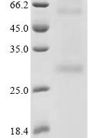 (Tris-Glycine gel) Discontinuous SDS-PAGE (reduced) with 5% enrichment gel and 15% separation gel.