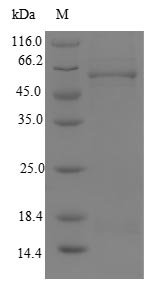 Recombinant Human Malonyl-CoA decarboxylase, mitochondrial (MLYCD), Homo sapiens (Human), E.coli, N-terminal 10xHis-tagged and C-terminal Myc-tagged, 55.9kDa, purity >90% as determined by SDS-PAGE.