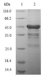 Recombinant Human Macrophage metalloelastase (MMP12)