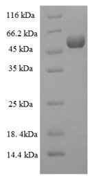 Recombinant Human Collagenase 3 (MMP13), Homo sapiens (Human), E.coli, N-terminal 6xHis-SUMO-tagged, 58.3kDa, purity >90% as determined by SDS-PAGE.