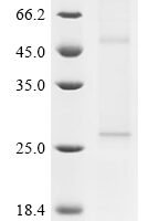 (Tris-Glycine gel) Discontinuous SDS-PAGE (reduced) with 5% enrichment gel and 15% separation gel.