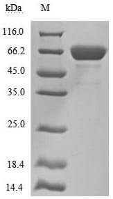Recombinant Human Mesothelin (MSLN), partial (Active), Homo sapiens (Human), Mammalian cell, N-terminal hFc-tagged, 59.6kDa, purity >90% as determined by SDS-PAGE.