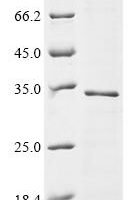 (Tris-Glycine gel) Discontinuous SDS-PAGE (reduced) with 5% enrichment gel and 15% separation gel.