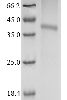 (Tris-Glycine gel) Discontinuous SDS-PAGE (reduced) with 5% enrichment gel and 15% separation gel.