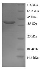 Recombinant Human Mucin-2 (MUC2), partial, Homo sapiens (Human), E.coli, N-terminal 6xHis-SUMO-tagged, 38.8kDa, purity >90% as determined by SDS-PAGE.