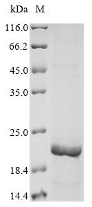 Recombinant Human Mucin-5B (MUC5B), partial, Homo sapiens (Human), E.coli, N-terminal 10xHis-tagged and C-terminal Myc-tagged, 18.9kDa, purity >85% as determined by SDS-PAGE.