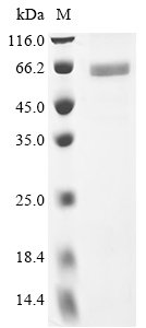 Recombinant Human N-myc proto-oncogene protein (MYCN), Homo sapiens (Human), Baculovirus, C-terminal 6xHis-tagged, 52.4kDa, purity >90% as determined by SDS-PAGE.