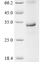 (Tris-Glycine gel) Discontinuous SDS-PAGE (reduced) with 5% enrichment gel and 15% separation gel.
