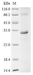(Tris-Glycine gel) Discontinuous SDS-PAGE (reduced) with 5% enrichment gel and 15% separation gel.