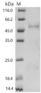 Recombinant Human Myosin regulatory light chain 12B (MYL12B), Homo sapiens (Human), Mammalian cell, C-terminal 10xHis-tagged, 21.2kDa, purity >85% as determined by SDS-PAGE.
