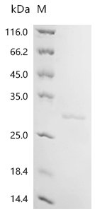 Recombinant Human Myosin regulatory light polypeptide 9 (MYL9), Homo sapiens (Human), E.coli, C-terminal 6xHis-tagged, 26.6kDa, purity >95% as determined by SDS-PAGE.