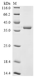 Recombinant Human Unconventional myosin-X (MYO10), partial