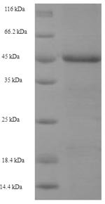Recombinant Human Baculoviral IAP repeat-containing protein 1 (NAIP), partial