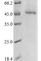 (Tris-Glycine gel) Discontinuous SDS-PAGE (reduced) with 5% enrichment gel and 15% separation gel.