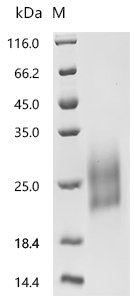 Recombinant Human Natural cytotoxicity triggering receptor 3 (NCR3), partial, Homo sapiens (Human), Mammalian cell, C-terminal 10xHis-tagged, 16.2kDa, purity >95% as determined by SDS-PAGE.