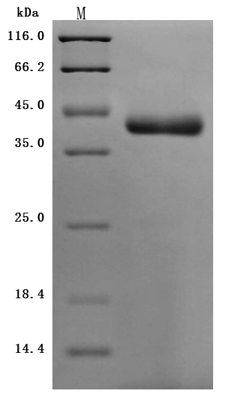 Recombinant Human Nectin-4 (NECTIN4), partial (Active), Homo sapiens (Human), Mammalian cell, C-terminal 10xHis-tagged, 36.9kDa, purity >95% as determined by SDS-PAGE.