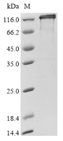 Recombinant Human E3 ubiquitin-protein ligase NEDD4-like (NEDD4L)
