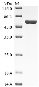 Recombinant Human Neurofilament light polypeptide (NEFL), partial