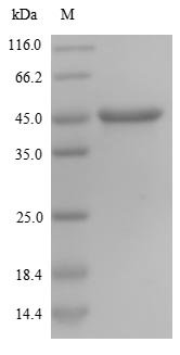 Recombinant Human Nestin (NES), partial, Homo sapiens (Human), Yeast, N-terminal 6xHis-tagged, 27.8kDa, purity >90% as determined by SDS-PAGE.