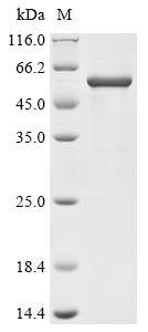Recombinant Human Nuclear factor NF-kappa-B p105 subunit (NFKB1), partial, Homo sapiens (Human), E.coli, C-terminal 6xHis-tagged, 54.4kDa, purity >90% as determined by SDS-PAGE.
