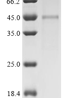 (Tris-Glycine gel) Discontinuous SDS-PAGE (reduced) with 5% enrichment gel and 15% separation gel.