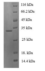 Recombinant Human Neuroglobin (NGB)