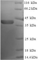 Recombinant Human Nucleolar protein 3 (NOL3)