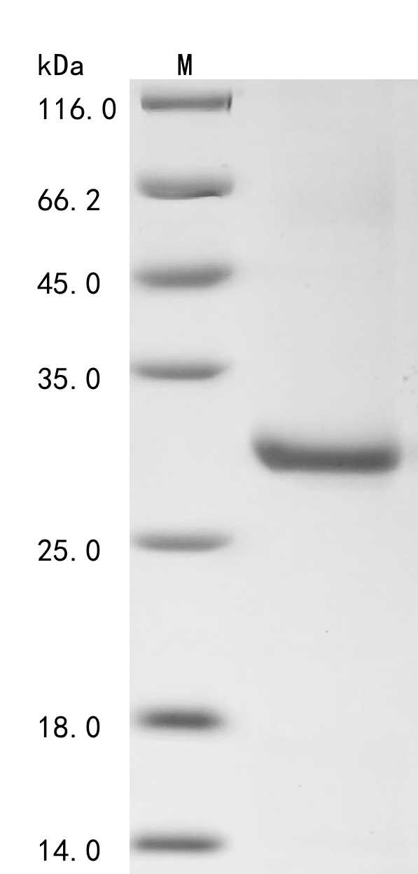 Recombinant Human Nitric oxide synthase, inducible (NOS2), partial