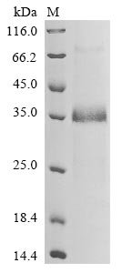 Recombinant Human Notch homolog 2 N-terminal-like protein B (NOTCH2NLB)