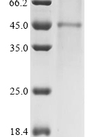 (Tris-Glycine gel) Discontinuous SDS-PAGE (reduced) with 5% enrichment gel and 15% separation gel.