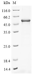 Recombinant Human Palmitoleoyl-protein carboxylesterase NOTUM (NOTUM)
