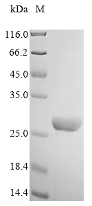 Recombinant Human Neuropeptide B (NPB)