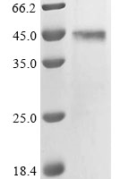 (Tris-Glycine gel) Discontinuous SDS-PAGE (reduced) with 5% enrichment gel and 15% separation gel.